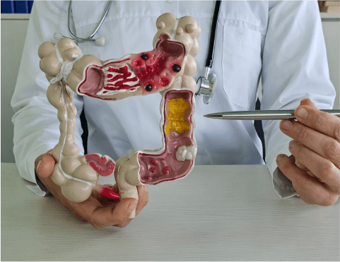 Colo-rectal Surgery