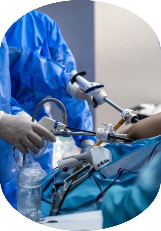 Gastrointestinal Laparoscopy Surgery