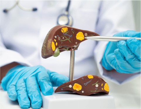 Hepato-Pancreato-Billiary Surgery