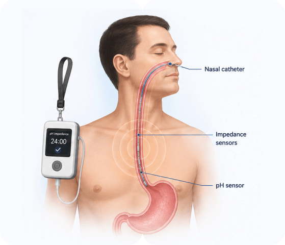24-Hour pH with Impedance Study