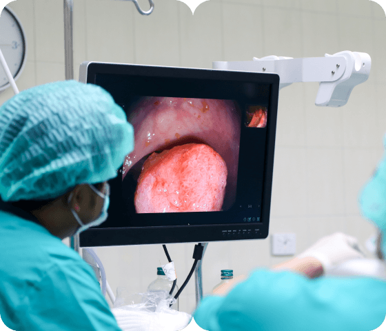 Endoscopy