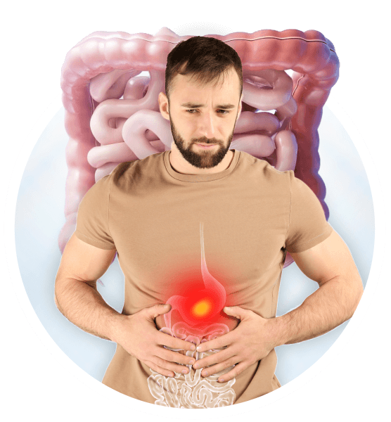 Permanent Solution for your GERD and Digestive Problems